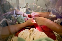 panda_cubs2013_b_incubator_umbilicalcord_wide_ZA_0426